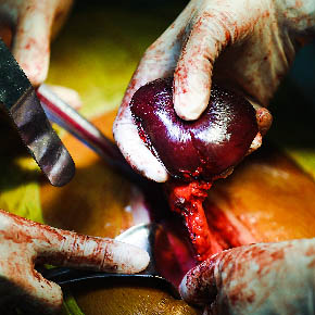 Medical Photojournalism:Honduras-for the AHPBA