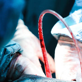 Medical Photojournalism:Honduras-for the AHPBA