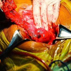 Medical Photojournalism:Honduras-for the AHPBA