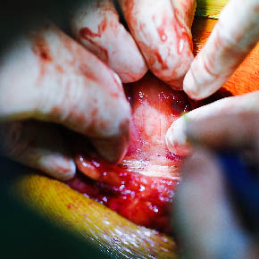 Medical Photojournalism:Honduras-for the AHPBA